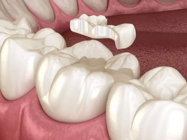 Restorative Dentistry