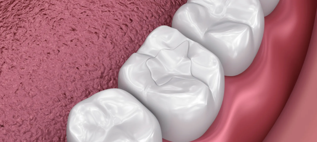 Sealants