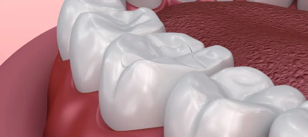 Sealants